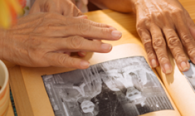 Cuidados de terapia ocupacional para personas mayores con demencia